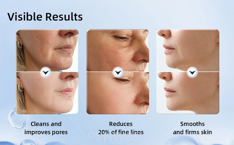 Neck and Facial skin tightening wand